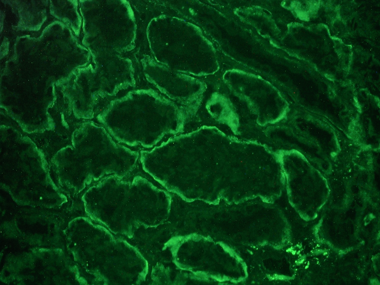 Figure 2: Integrin alpha 6B immunostaining of the basolateral membrane of epithelial cells in a frozen section of human kidney using MUB0905P at a 1:100 dilution.